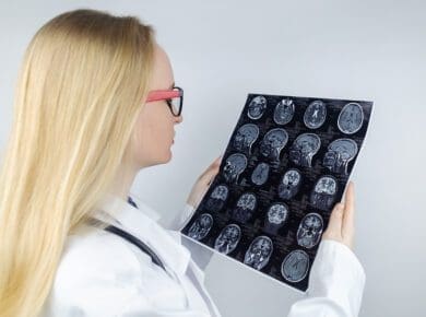 MRI of the brain. Neuropathologist holds a picture against the background of a light device to check for coup vs. contrecoup brain injuries