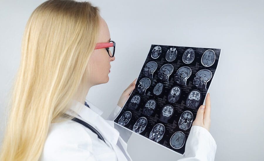 MRI of the brain. Neuropathologist holds a picture against the background of a light device
