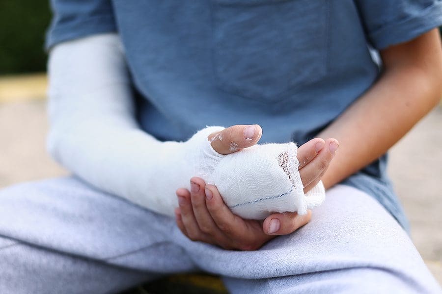 Broken Bones Vs. Fractures: Key Facts About Bone Injuries