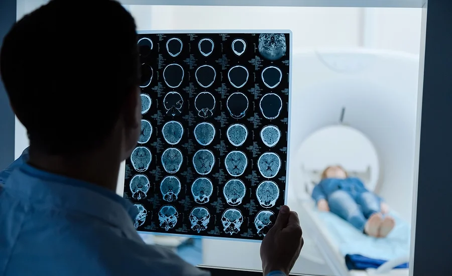 doctor looking at an MRI scan of a patient with a traumatic brain injury from an accident