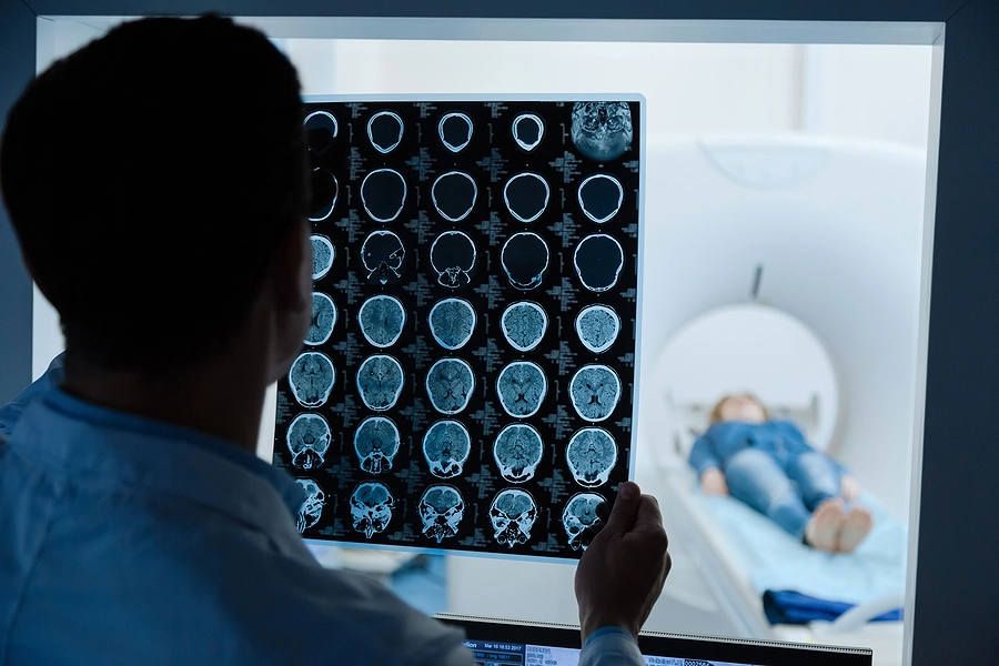 doctor looking at an MRI scan of a patient with a traumatic brain injury from an accident